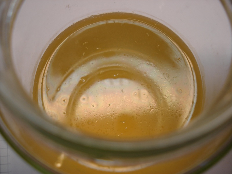 white particles in urine
